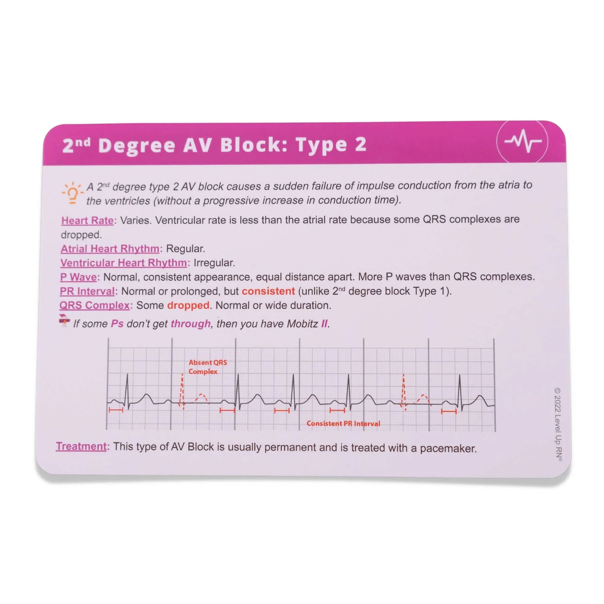 EKG Interpretation - Nursing Flashcards - Image 6